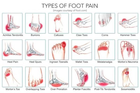 These Simple Exercises Provide Foot Pain Relief in 5 Minutes ...