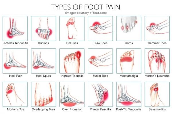 These Simple Exercises Provide Foot Pain Relief in 5 Minutes