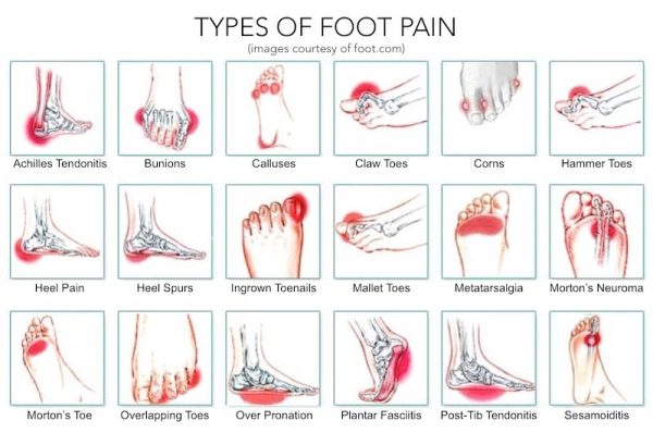 these-simple-exercises-provide-foot-pain-relief-in-5-minutes