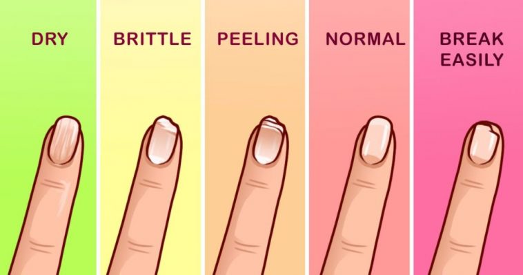 What Your Nails Say About Your Health 8 Pictures 99easyrecipes