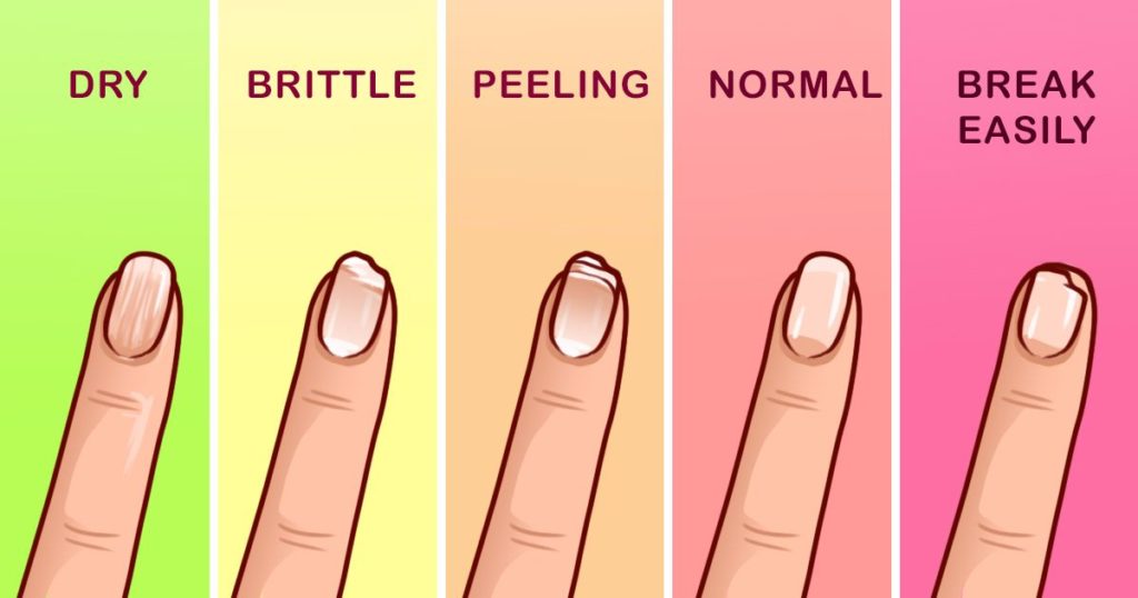 What Your Nails Say About Your Health (8 Pictures) – 99easyrecipes