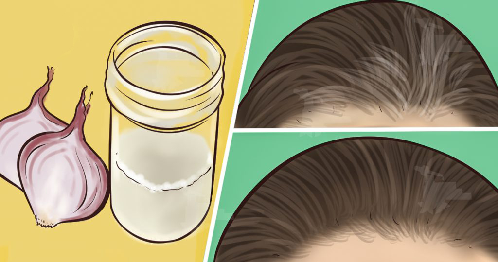 Onion Juice It Turns Gray Hair Back To Its Natural Color Page 2
