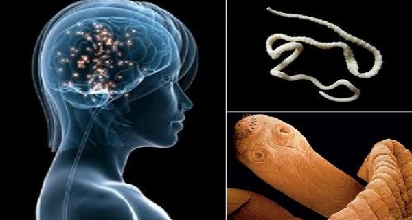 If You Are Eating This Common Food You Have BIG Chance To Get Brain Worms 2024 | TIPS