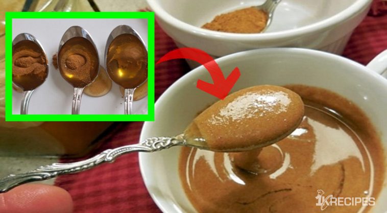 Doctors Have No Explanation: Boil Cinnamon And Honey And Cure Arthritis, Cancer, Gallbaladder, Cholesterol And 10 Other Diseases 2024 | TIPS