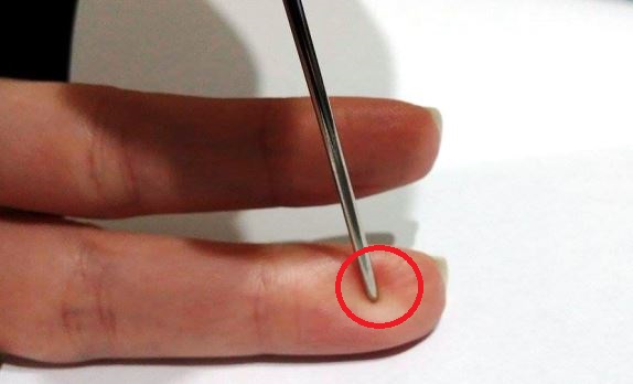 HERE'S HOW TO SAVE YOUR OR SOMEONE ELSE'S LIFE FROM STROKE USING ONLY A NEEDLE – 99easyrecipes
