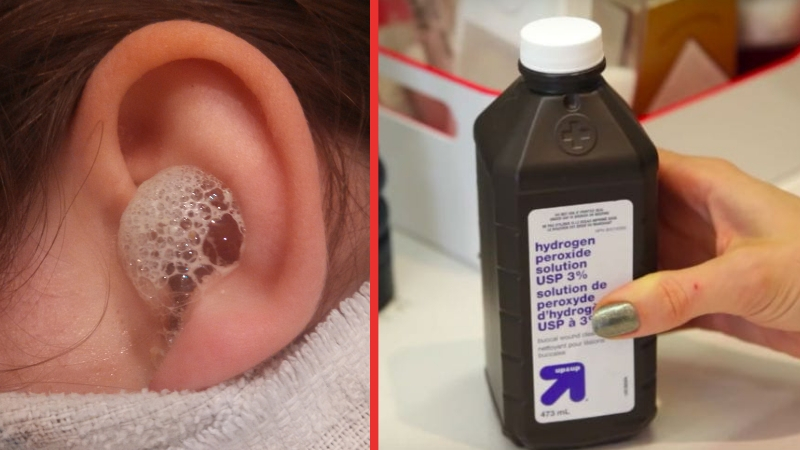 How To Use Hydrogen Peroxide To Combat Ear Infections And More 99easyrecipes